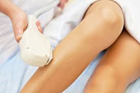laser hair removal in auckland